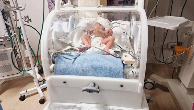 Bebé en una de las incubadoras creadas por Pablo