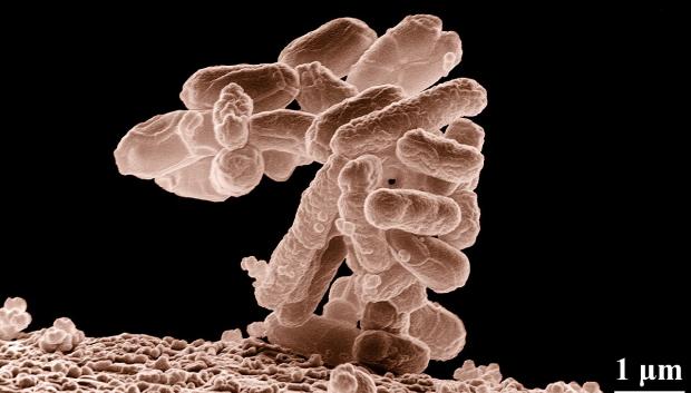 Micrografía electrónica, de baja temperatura, de un cúmulo de bacterias E. coli