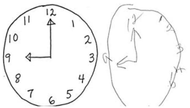 El test del reloj