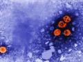 Imagen de transmisión coloreada digitalmente revela la presencia de viriones de la hepatitis B.