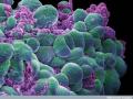 Células cancerígenas, vistas en 3D
