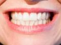 La importancia de la higiene dental