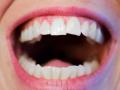 Los dientes no son blancos, su color se acerca más al del marfil