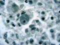La ameba comecerebros, a vista microscópica
