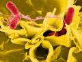 Bacteria salmonella, salmonela