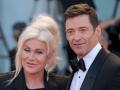 Actors Hugh Jackman and Deborra Lee Furness at the premiere of the film 'The Son' during the 79th edition of the Venice Film Festival in Venice, Italy, Wednesday, Sept. 7, 2022.