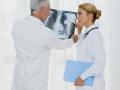 Doctores analizando una radiografía de cáncer de pulmón