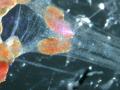 Neurona en su ganglio iluminada por láser infrarrojo de onda continua