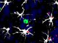 Células en torno a una metástasis cerebral en modelo animal