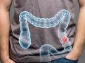 Imagen para promocionar el cribado de cáncer colorrectal