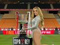 Melody tuvo que grabar su actuación en la final de la Copa del Rey