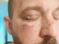 Imagen del guardia civil tras la agresión en Roquetas de Mar