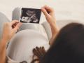 Una mujer embarazada mira la ecografía de su bebé