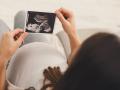 Una mujer embarazada mira la ecografía de su bebé