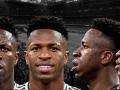 El antes y después del rostro de Vinicius Jr. tras pasar por el quirófano