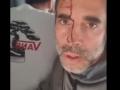 atentado avión de FlyDubai