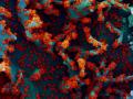 Micrografía electrónica de barrido coloreada de una célula infectada con coronavirus