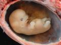 Un embrión humano, aproximadamente a las 8 semanas de gestación.