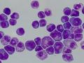 Células madre hematopoyéticas y células proleucémicas en cultivos celulares del estudio