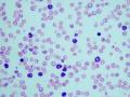 Granulocytes in blood samples from mice with chronic myelogenous leukemia