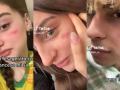 Varios jóvenes muestran su 'cicatriz francesa' en vídeos de TikTok