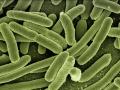 E. coli, un tipo de bacteria