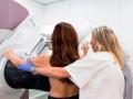 Una mujer se somete a una mamografía