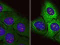 Células normales (i) y células sometidas al efecto de la proteína tóxica (d)