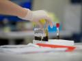 Un análisis de sangre puede calcular la edad real de nuestros órganos