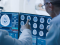 Un médico y un radiólogo discuten el diagnóstico en unos monitores que muestran resultados de las exploraciones del cerebro