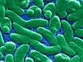 Vibrio vulnificus