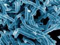 Imagen de microscopio de la bacteria Mycobacterium tuberculosis