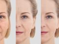La evidencia científica refuerza el papel de la Dermatología en la prevención de enfermedades asociadas a la edad