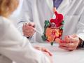Cáncer de intestino