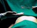 Médico antes de realizar un aborto