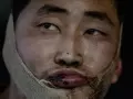 Soldado de Corea del Norte atrapado por el Ejército de Ucrania