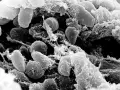 Bacteria Yersinia pestis