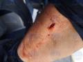 Policía herido en La Coruña