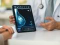 Un doctor muestra una prueba diagnóstica de cáncer de mama