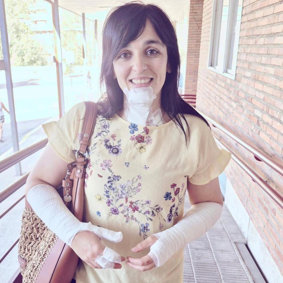 La líder de Aliança Catalana, Sílvia Orriols, con vendas en la cara y los brazos