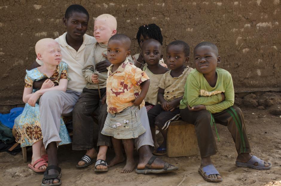 Dos niños albinos, estigmatizados por el color de su piel, en un fotograma del documental