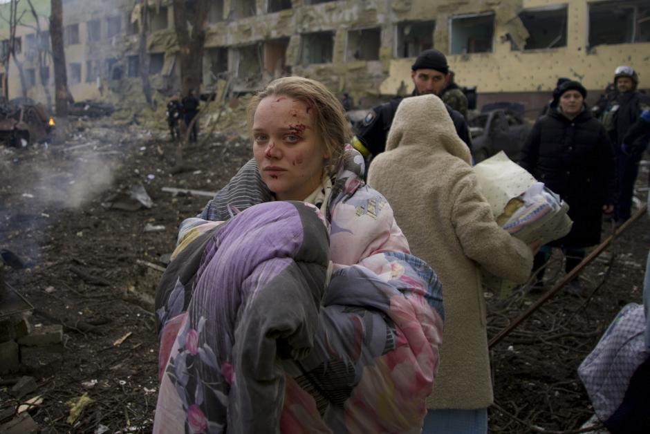 Una gestante, tras sobrevivir al bombardeo al hospital de maternidad atacado por Rusia el pasado 9 de marzo