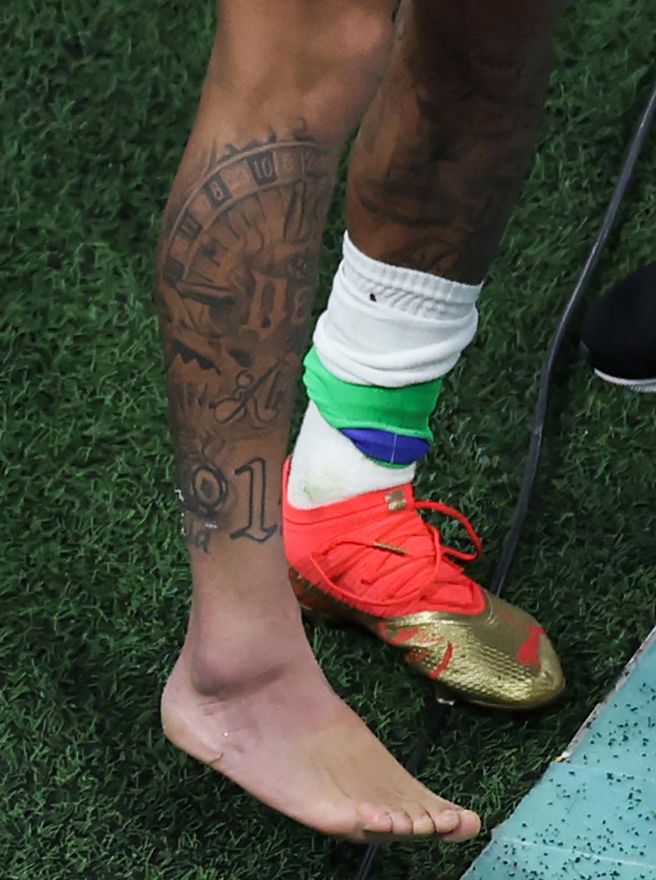 Imagen del tobillo hinchado del jugador brasileño tras la entrada sufrida ante Serbia