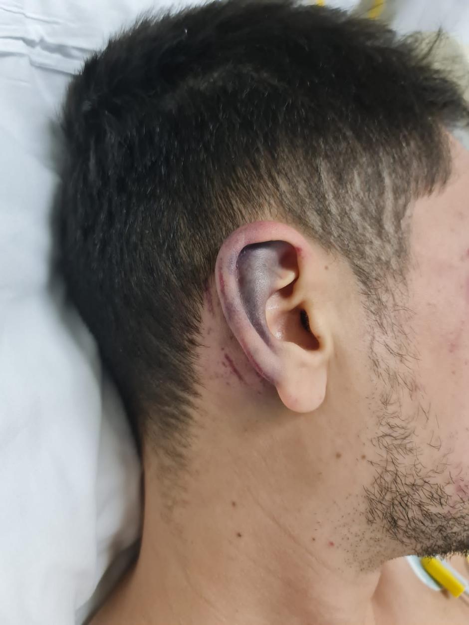 El cantante muestra alguna de sus heridas en el hospital