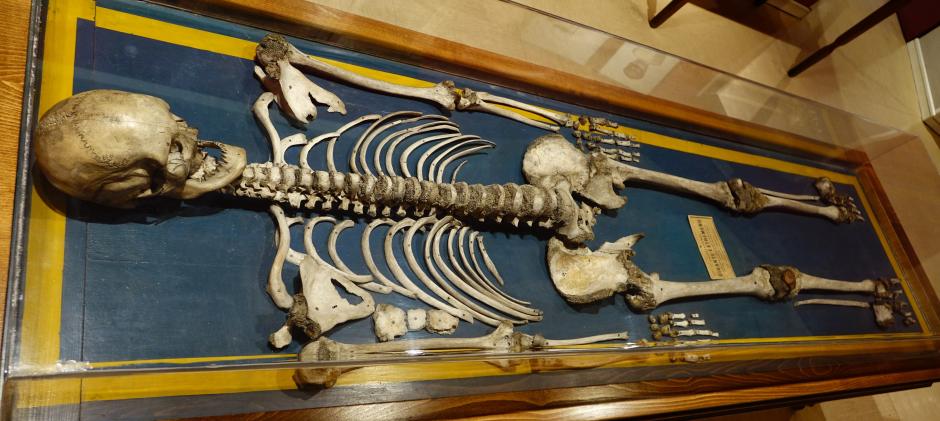Esqueleto de Agustín Luengo, 'el Gigante Extremeño' en el Museo Nacional de Antropología.