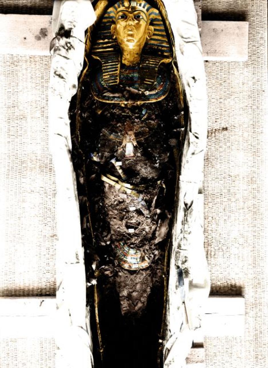 El examen y la autopsia del cuerpo de Tutankamón se llevaron a cabo durante nueve días en noviembre de 1925. El lino utilizado para envolver el cuerpo del rey se carbonizó y se redujo a polvo. El comité de examen retiró los restos pulverulentos de la tela, para revelar el cuerpo del rey protegido por múltiples capas de joyas simbólicas y objetos rituales. Harry Burton tomó una serie de fotografías antes y después de retirar cada capa de objetos. La fotografía documenta un collar de halcón que cubre el pecho de Tutankamón y una daga ceremonial en la cintura. La famosa máscara de oro está colocada sobre la cabeza y la parte superior del pecho del rey.