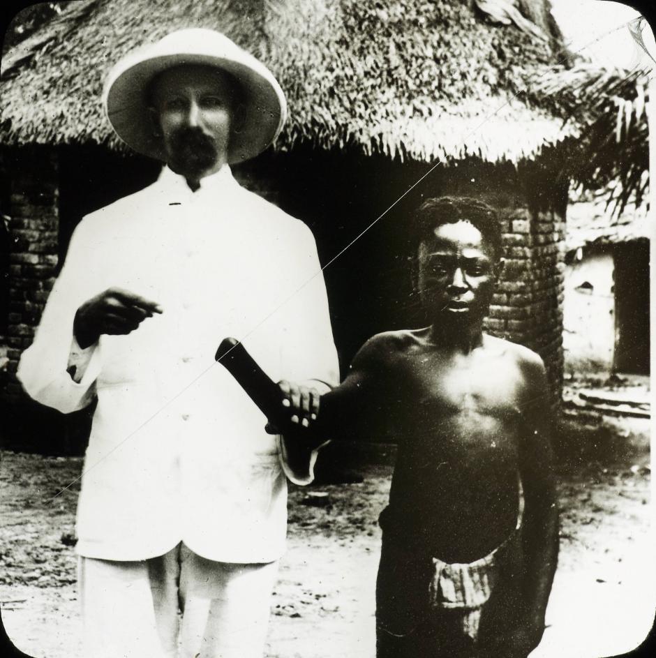 Un misionero señala a la mano cortada de un aldeano congoleño. Las manos cortadas eran «el símbolo más poderoso de la brutalidad colonial» en el Congo.