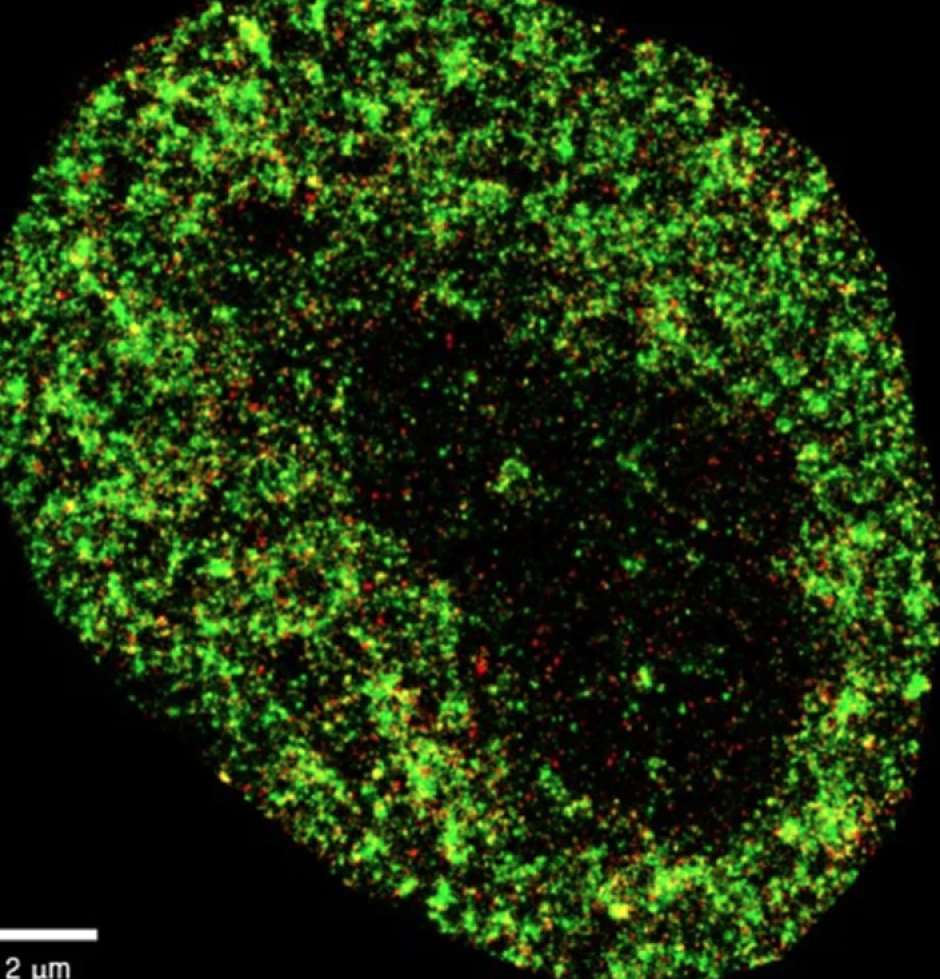 Imagen de altísima resolución de una célula cancerosa