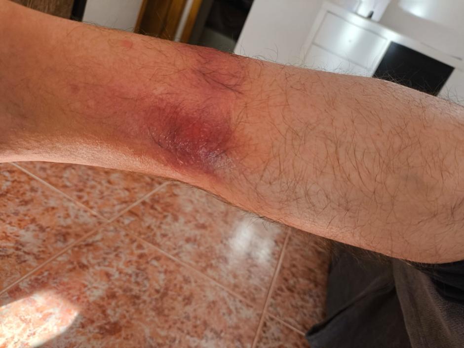 Brazo de un agente del CNP que trabaja en la comisaría provincial de Alicante