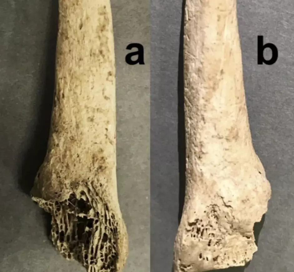 Imagen del dedo de Calderón de la Barca que se conserva en el museo MAE